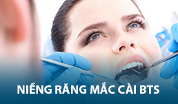 Niềng răng mắc cài bts