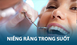 Niềng răng trong suốt
